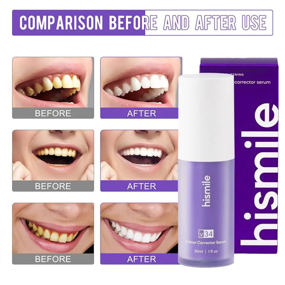 Teeth Brightening Hismiles V34 Colour Corrector Serum