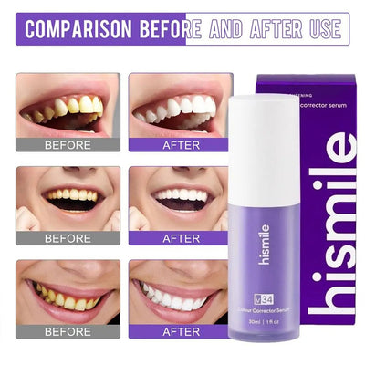 Teeth Brightening Hismiles V34 Colour Corrector Serum